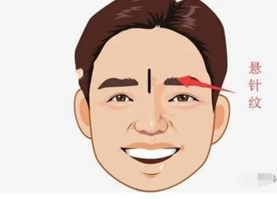 悬针纹面相图解 有悬针纹的人命运好不好