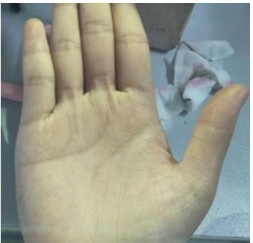 手相重要  掌纹更重要  但手掌颜色更加重要