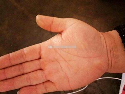 手纹乱怎么回事 手纹乱会有哪些影响