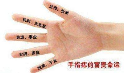 手背长痣好不好 手背长痣预示着什么
