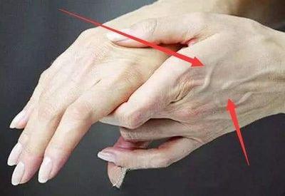 手背露青筋的人是不是命苦 手背露青筋是什么意思