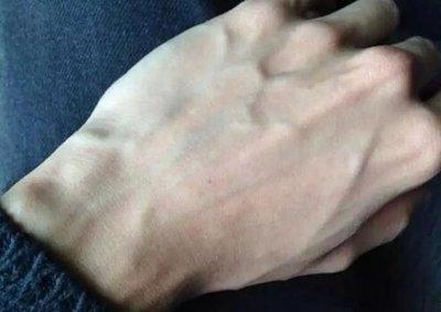 手背露青筋的人是不是命苦 手背露青筋是什么意思
