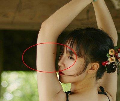 手臂有痣的人会大富大贵吗 手臂长痣是什么意思