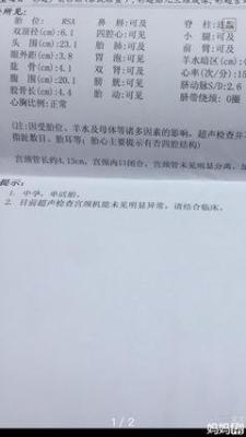 做梦梦见梦见捉了很多黄鳝是什么意思