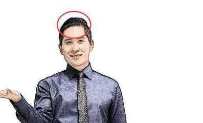 头尖额窄这种面相的人会怎么样 分析头尖额窄面相好坏