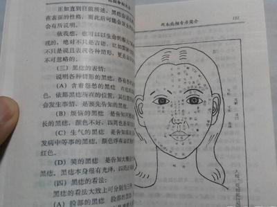 女人3颗好命痣 女人什么地方长痣命好