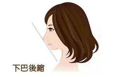 女人下巴面相分几种 看女人下巴了解运势