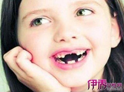做梦梦见牙掉 牙掉了 牙齿掉是什么意思