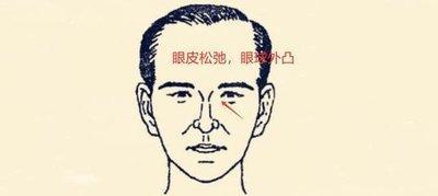 女人什么面相心眼小 女人小气的面相