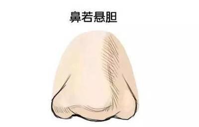 日月角突出的人命运如何 日月角突出是什么意思
