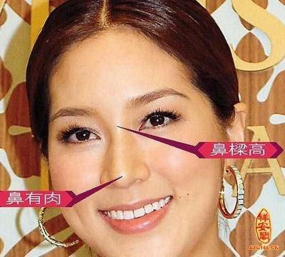 有钱人面相的三大特征有其中一个就很好