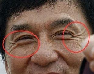 有鱼尾纹女人面相的命好不好 女人长鱼尾纹是什么意思