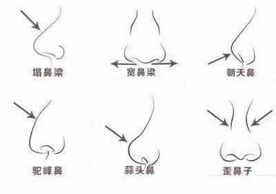 朝天鼻代表什么面相 长有朝天鼻的人命运好吗