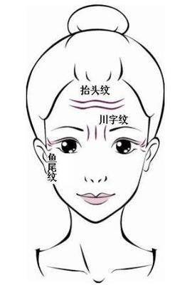 有抬头纹好不好 分析有抬头纹的命运