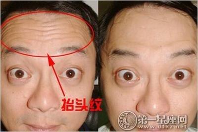 有抬头纹的男人面相意味着什么 男人长抬头纹怎样