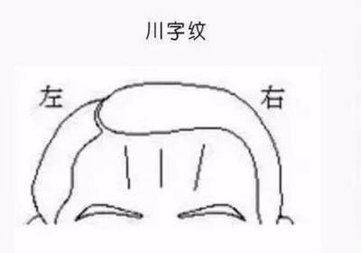 有抬头纹的面相图解大全 长有抬头纹会带来什么影响