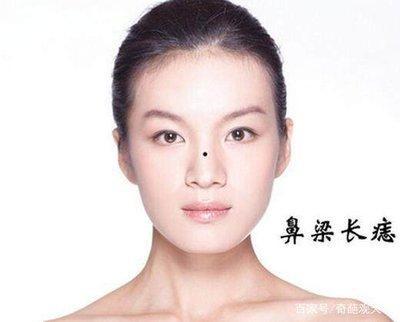 天生大富大贵痣 这几种痣相的人富贵命
