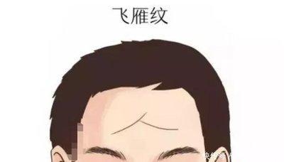 天生有抬头纹的人代表什么 天生长有抬头纹是什么意思