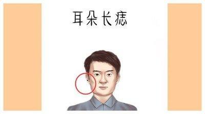 最有福气的3处吉痣 哪里长痣有福气