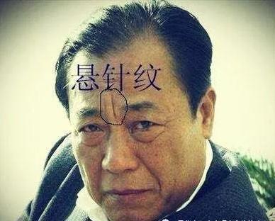 有悬针纹的女人面相如何呢 女人长悬针纹好不好