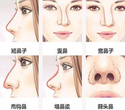没有鼻梁鼻子塌的人是什么体验 没有鼻梁的人命运如何