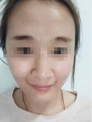 法令纹不对称影响命运吗 法令纹不对称好不好
