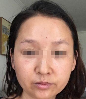 法令纹不对称的面相好不好 法令纹不对称会有什么影响