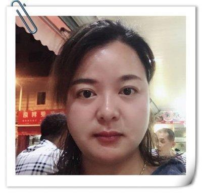 法令纹不对称面相如何 法令纹不对称会有哪些影响