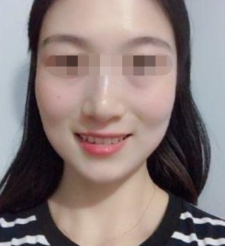 法令纹不对称面相有何说法 法令纹不对称会怎样