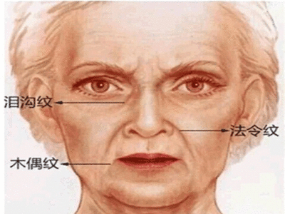 法令纹入口的女人面相好不好 女人法令纹入口说明什么