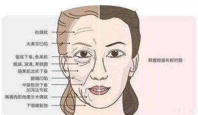 法令纹左右不对称面相分析 法令纹部队称是什么意思