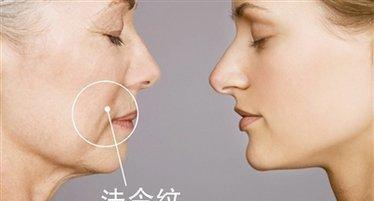 法令纹看人命运好坏 法令纹面相如何看