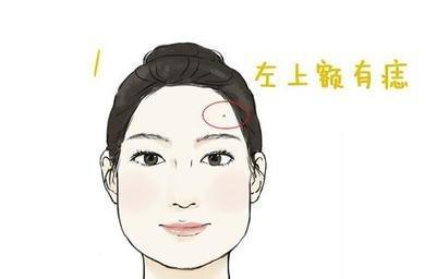 点痣到底好不好 哪些地方的痣不能点