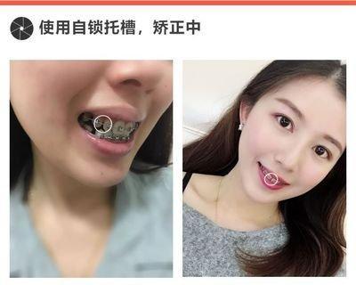 牙齿不齐的女生命运  女人牙齿不整齐好不好