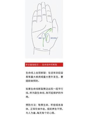 生命线断开手诊图解 你知道生命线断开有哪些含义呢