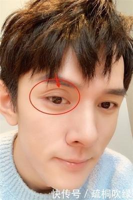 男人有三眼皮代表什么命 男人三眼皮是什么意思
