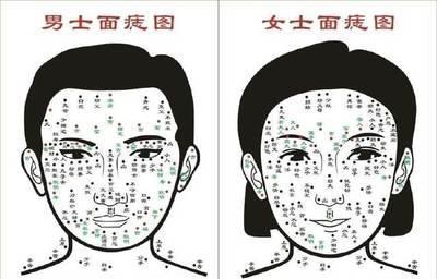 男人极少见的富贵痣 富贵男人痣相分析