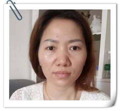 男女法令纹面相图解 法令纹面相代表什么