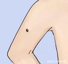 男女痣相图解大全 身上长痣是好还是不好