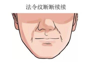 男子法令纹面相最全分析 男人长法令纹是啥意思