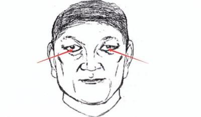 男人三白眼面相的相关解析 为什么说三白眼男人不好