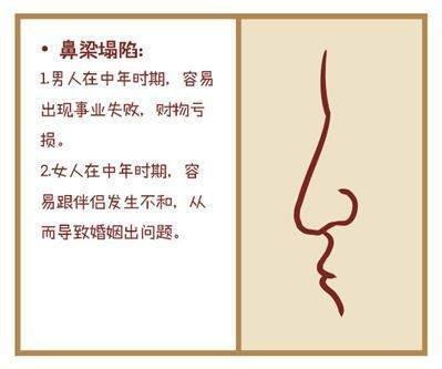 男人的鼻相应该怎么看 男人鼻相解读