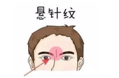 男人印堂有悬针纹好吗 男人印堂长悬针纹说明什么
