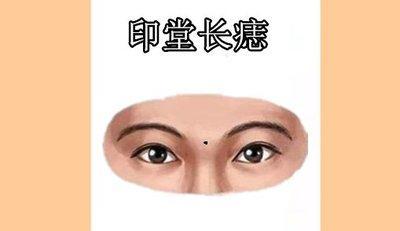 男人印堂有痣好不好 男人印堂长痣是什么意思