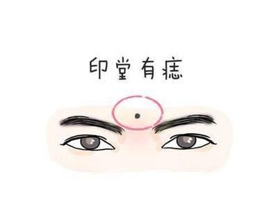 男人印堂有痣好不好 男人印堂长痣是什么意思
