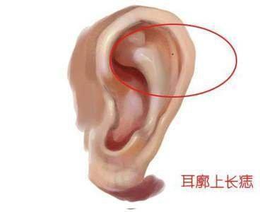 男人耳朵有痣的命运如何 耳朵长痣的男人面相分析