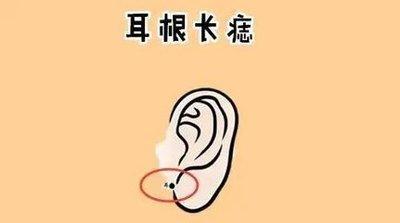 男人耳朵长痣面相图解析 耳朵有痣的男人命运好吗