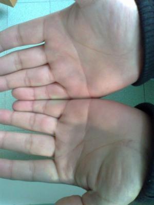 男人双手断掌是什么命 双手断掌的男人命运好不好