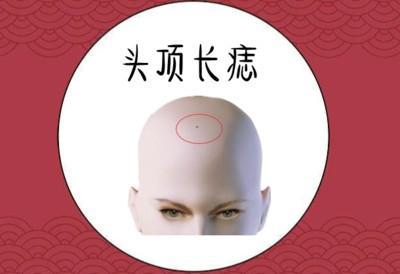 男人发财痣 男人哪些地方长痣能发财