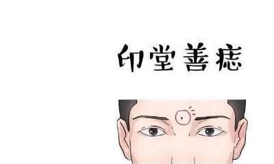 男人发财痣 男人哪些地方长痣能发财